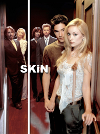 voir serie Skin en streaming